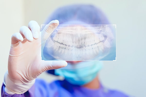 Dental Implants Clinic Edmonton
